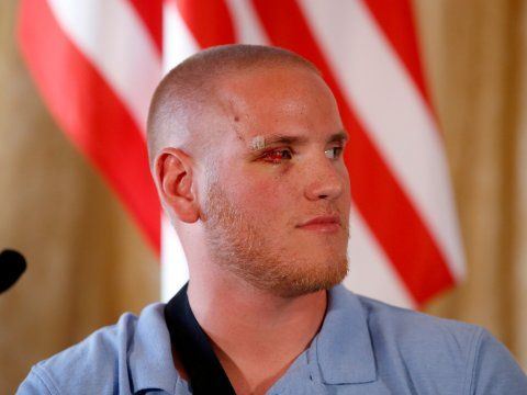 Spencer Stone injured