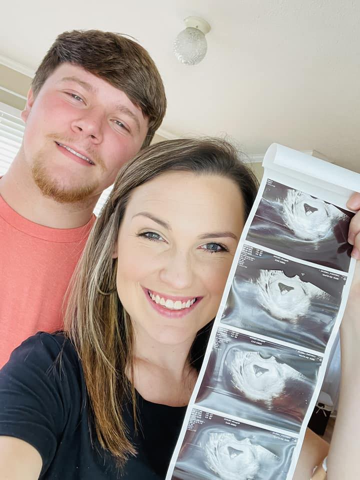 Tyler Doyle and wife showing baby on the way