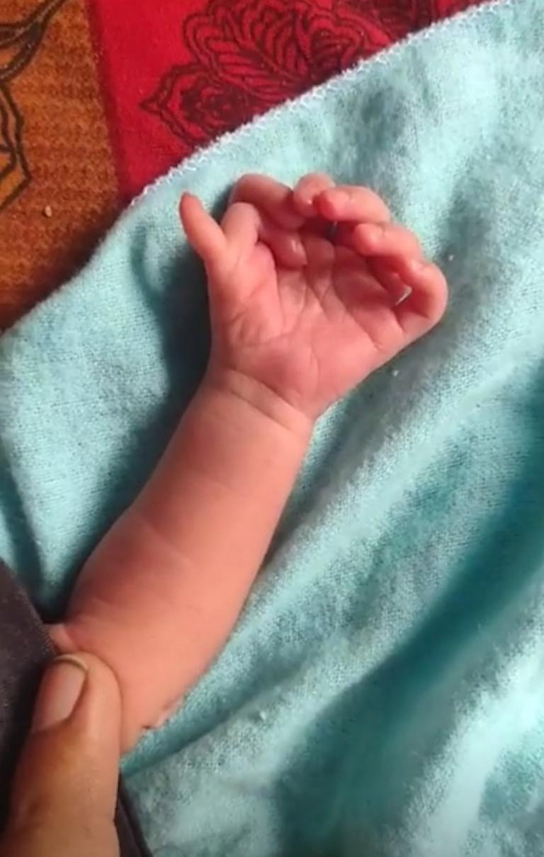 Baby girl born with 14 fingers, 12 toes hailed as incarnation of Hindu goddess 2