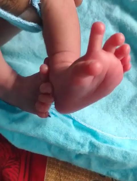 Baby girl born with 14 fingers, 12 toes hailed as incarnation of Hindu goddess 3