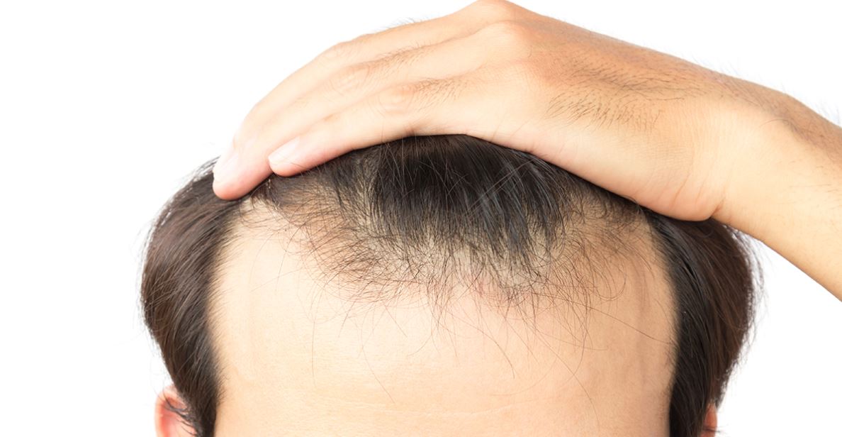 Tips To Stop Hair Loss Tm Media Inc