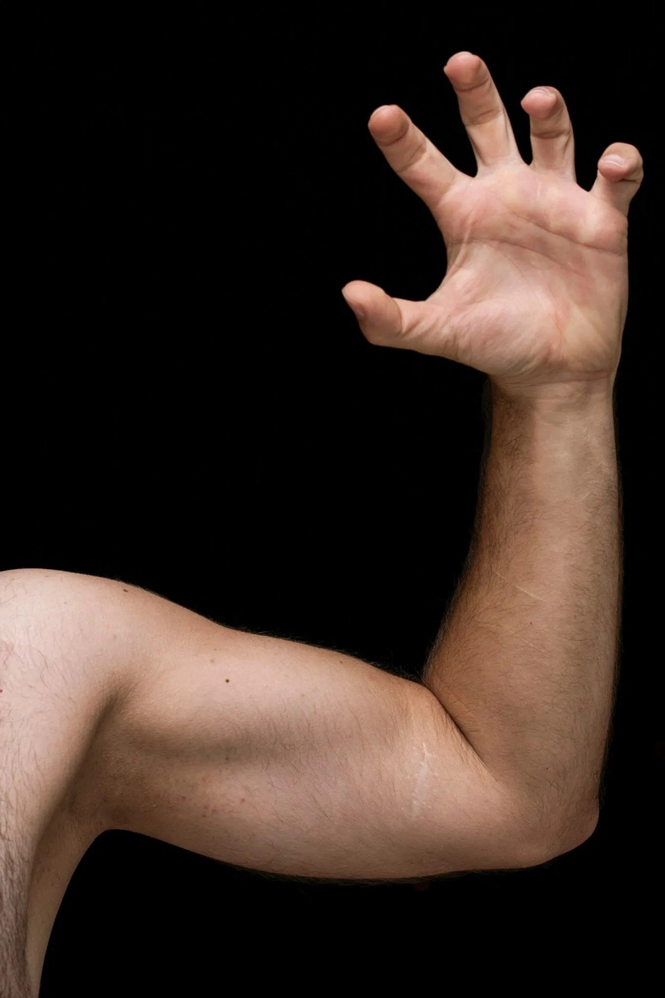 Shoulder pain arm claw