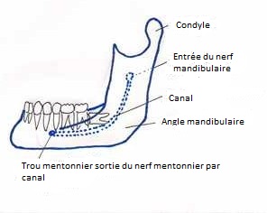 Accidents D Extraction Lesion Du Nerf Alveolaire Inferieur Ou Nerf Dentaire Inferieur Ou Nerf Mandibulaire Conseil Dentaire Dr Hauteville