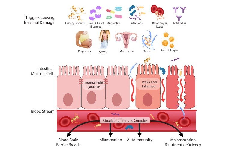 Get The Skinny On Leaky Gut Dr Becky Campbell