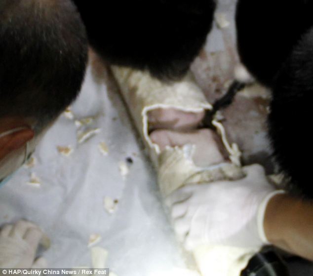 Unbelievably, the baby survived the ordeal, which saw him having to be cut out of a pipe