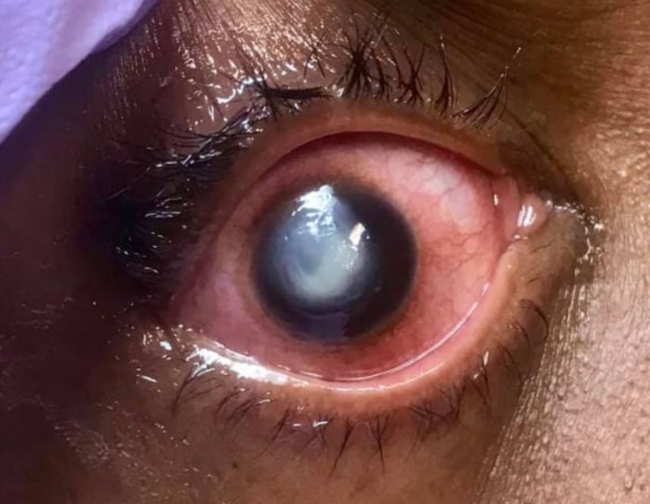 In Direzione Mite Balcone Ho Dormito Con Le Lenti Stampa Collegamento Media