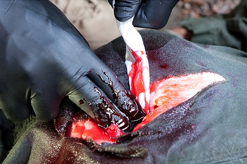 Agentes hemostáticos en venda o vendas estándar para los sangrados de riesgo vital en la unión de miembros