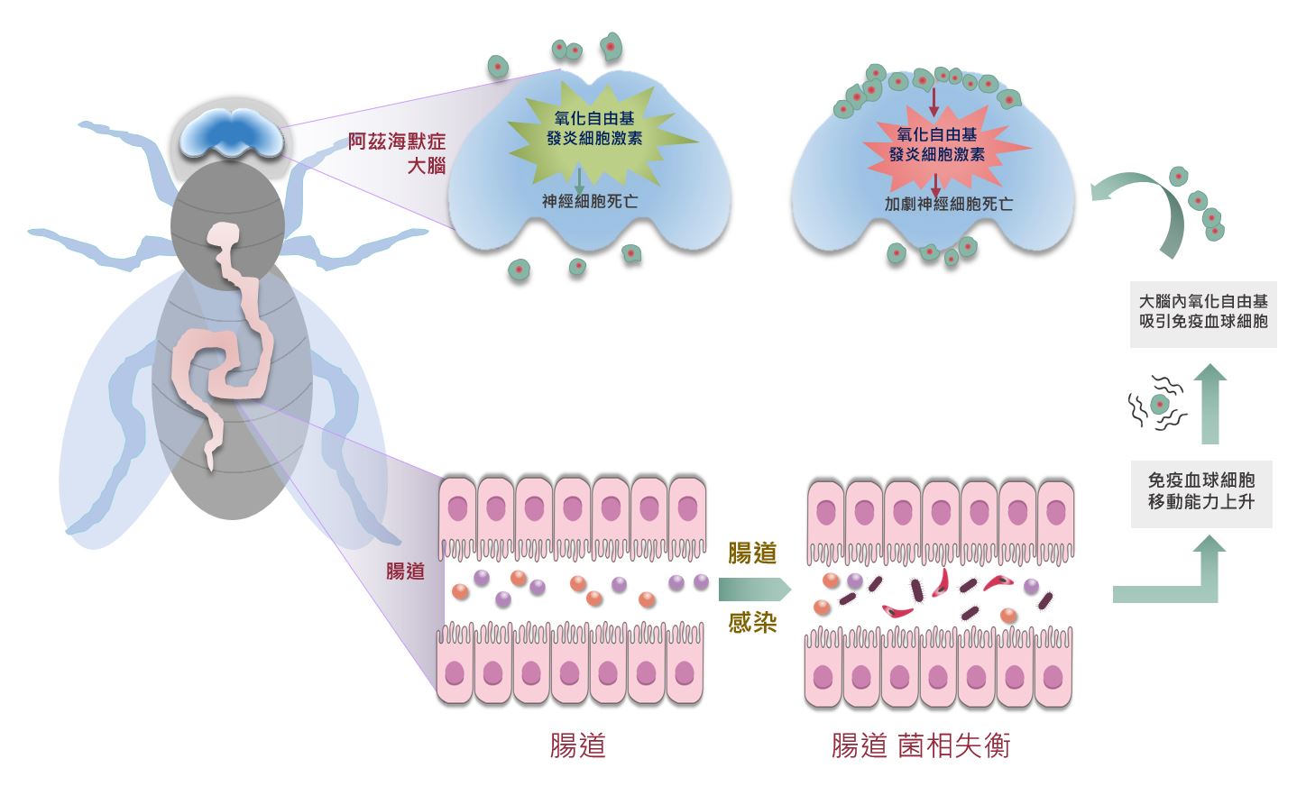 國衛院研究團隊發現腸道可以影響阿茲海默症病程 生醫觀點biomed 關注生醫分享觀點