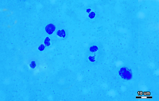 Key Difference Between Somatic Cells and Gametes