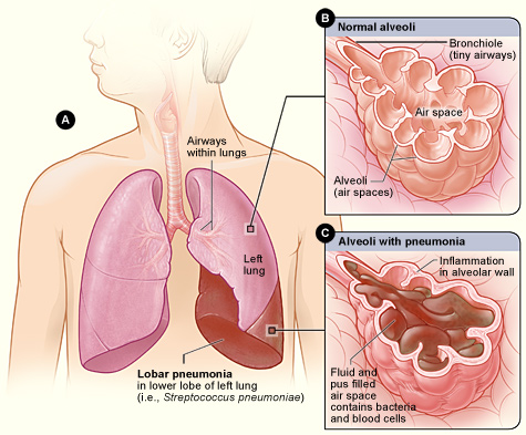 Key Difference Between Right and Left Lung