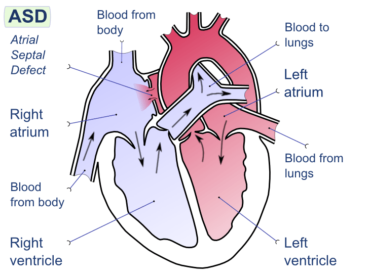 Difference Between Left and Right Side of Heart_Fig 02