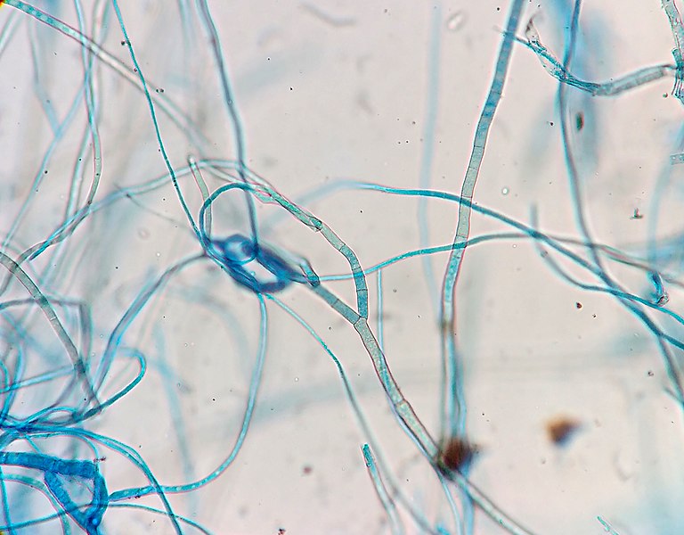 Difference Between Hyphae and Pseudohyphae