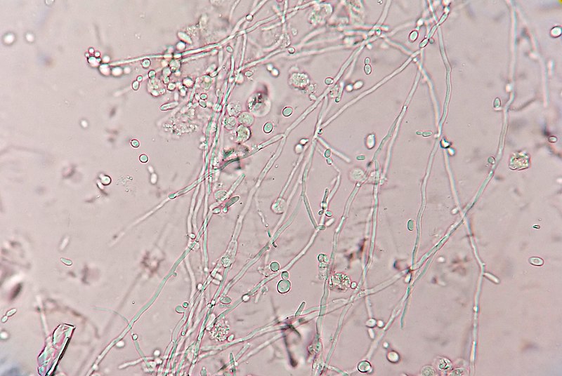 Difference Between Hyphae and Pseudohyphae