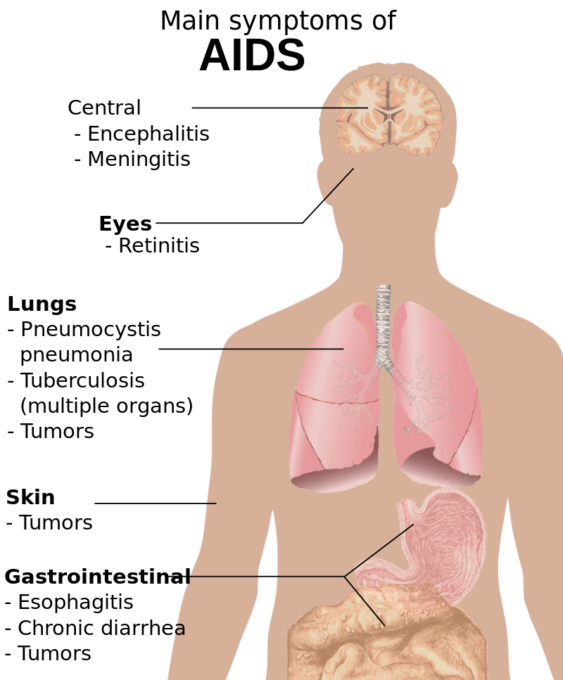 Key Difference - Autoimmune Disease vs Immune Deficienc