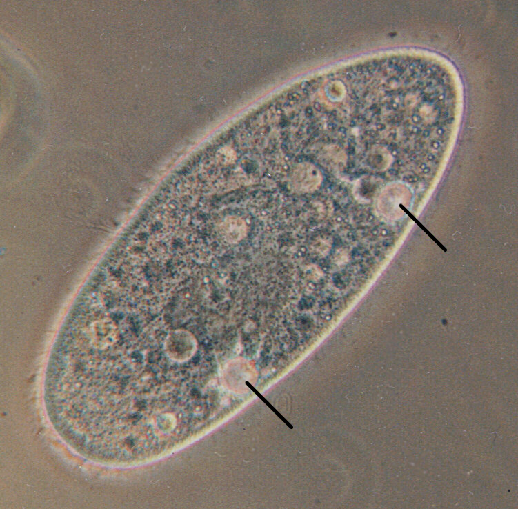 Difference Between Food Vacuole and Contractile Vacuole