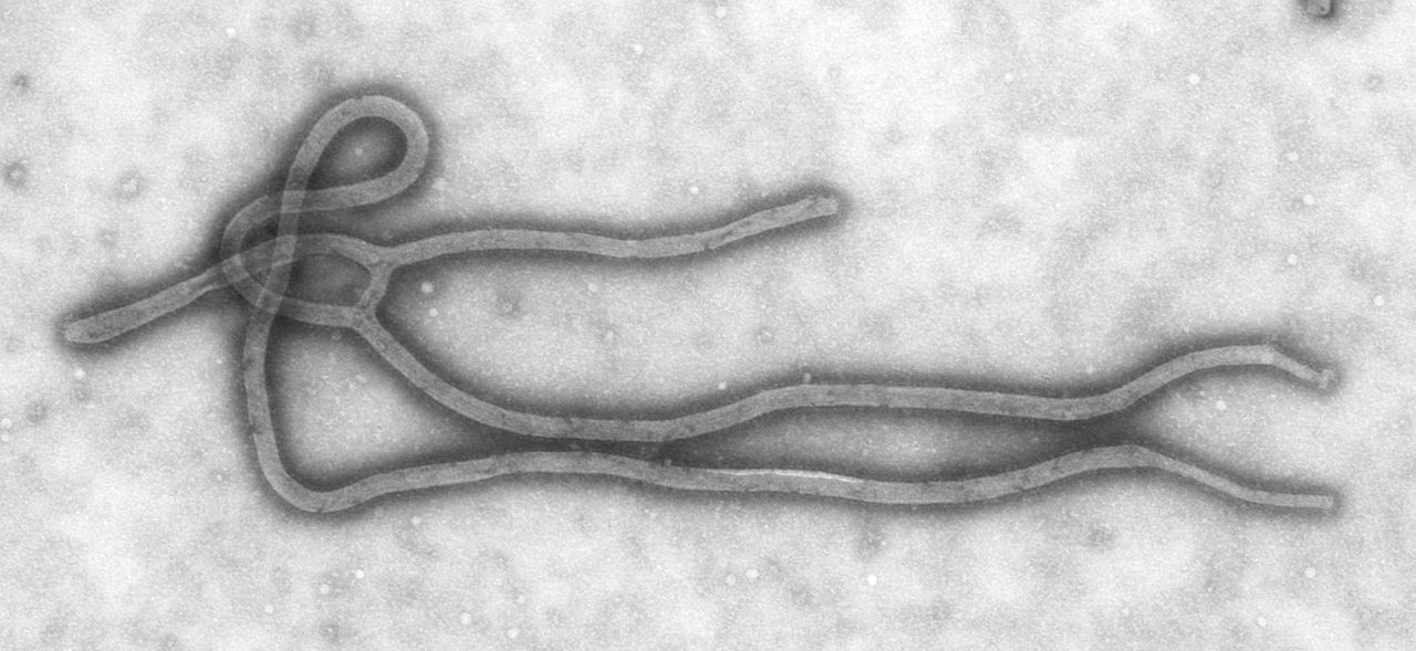 Key Difference Between Positive and Negative Sense RNA Virus