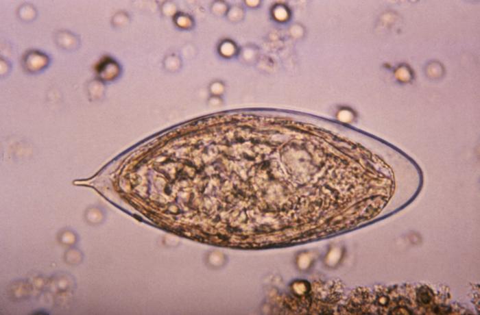 Key Difference - Schistosoma Mansoni vs Haemotobium