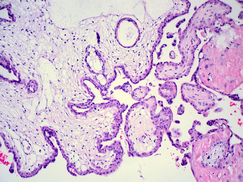 Key Difference Between Complete and Partial Mole 