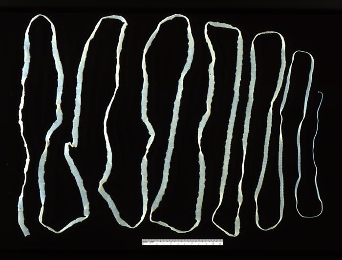 Key Difference Between Nematodes and Cestodes