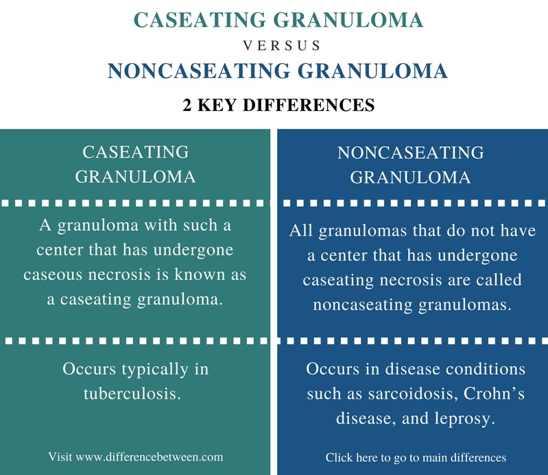 Difference Between Caseating and Noncaseating Granuloma - Comparison Summary