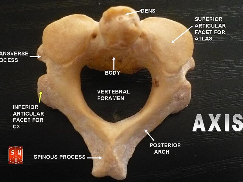 Key Difference - Typical vs Atypical Vertebrae