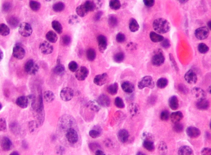 Key Difference - B cells vs Plasma Cells