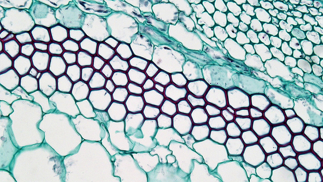 Difference Between Collenchyma and Chlorenchyma