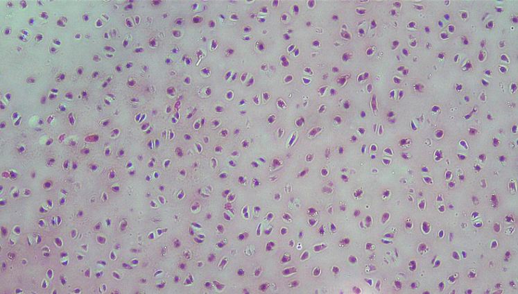 Key Difference - Fibrocartilage vs Hyaline Cartilage