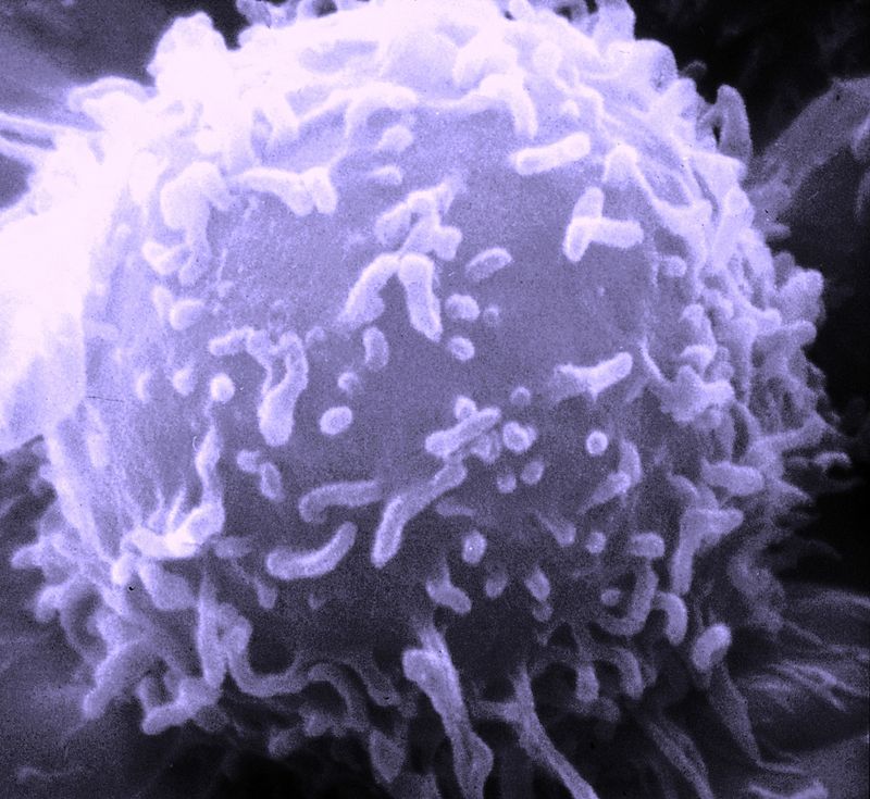 Key Difference - Monocyte vs Lymphocyte