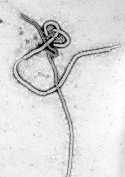 Key Difference - DNA Vaccine vs Recombinant Vaccine