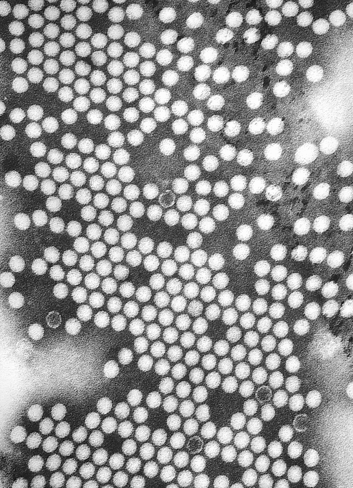 Difference Between SEM and TEM