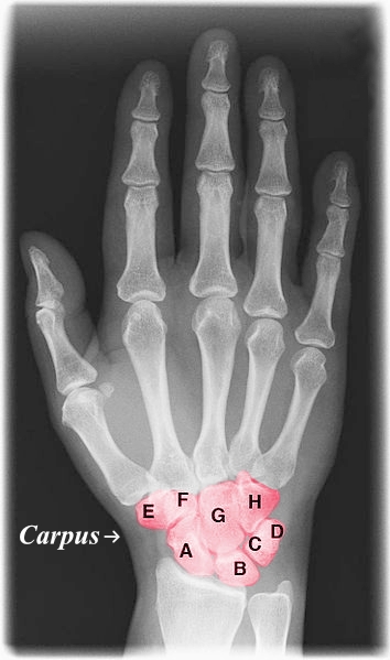 Key Difference - Tarsal vs Carpal Bones