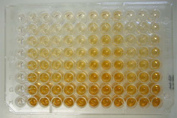 Key Difference - Elisa vs Western Blot