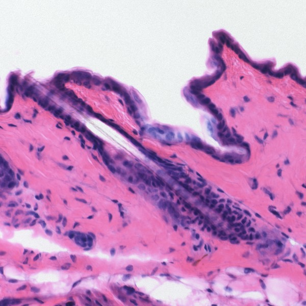 Difference Between Progressive and Regressive Staining