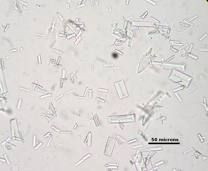 Difference Between Amorphous Urate and Phosphate