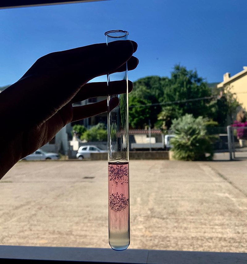 Key Difference - Plant vs Animal DNA Extraction