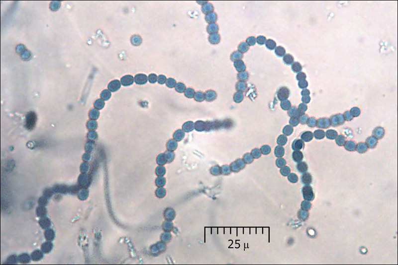 Difference Between Mucilaginous Sheath and Gelatinous Sheath