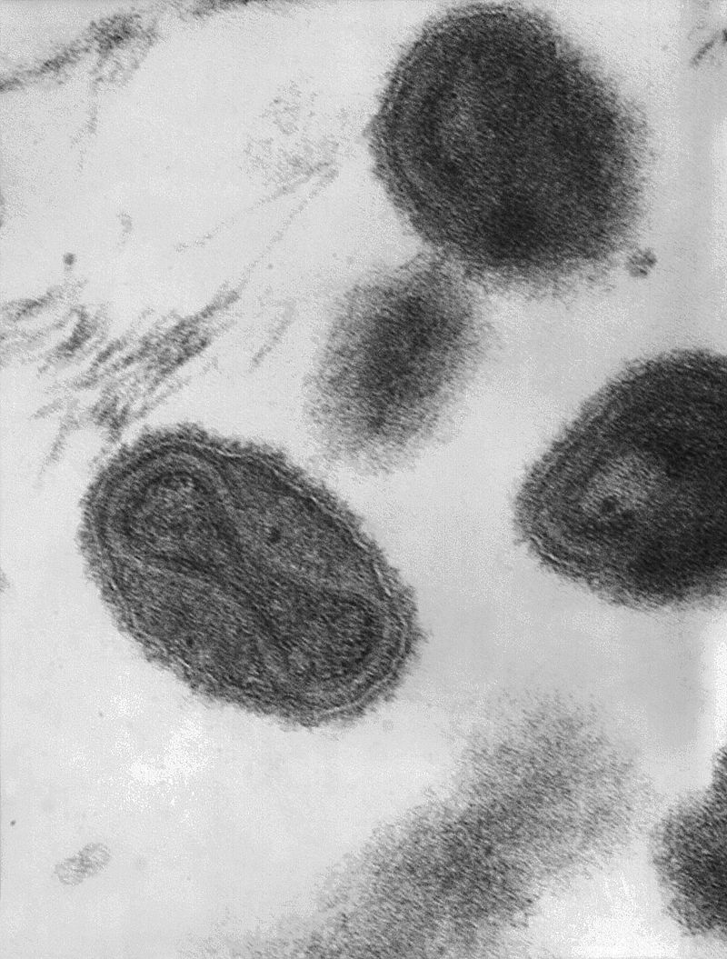 Smallpox - Variola Virus