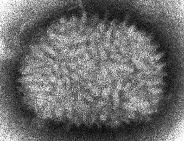 Vaccinia Virus