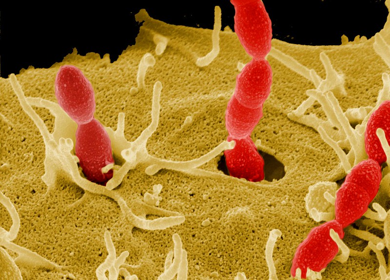 Streptomyces vs Streptococcus in Tabular Form