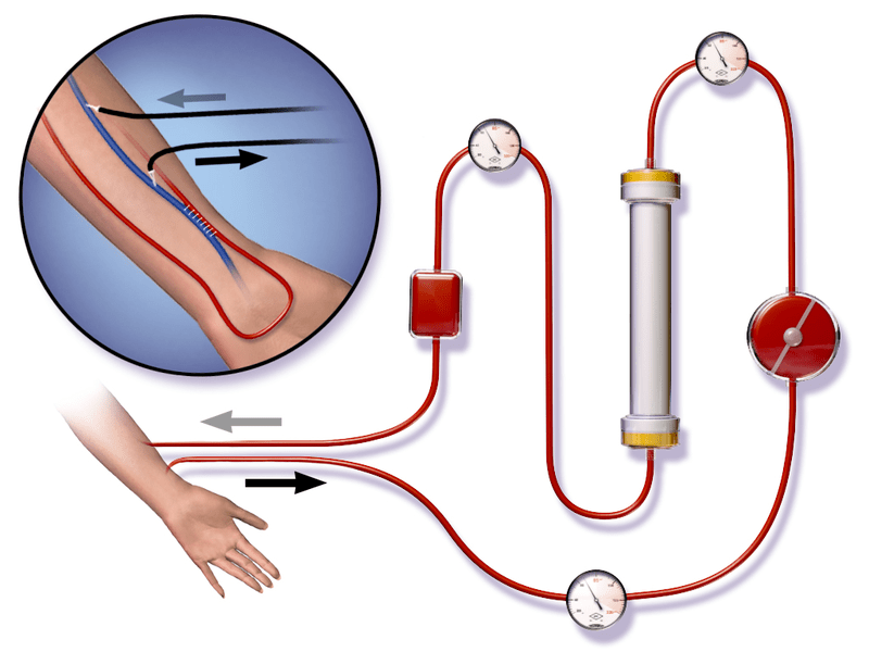 Dialysis vs CRRT in Tabular Form