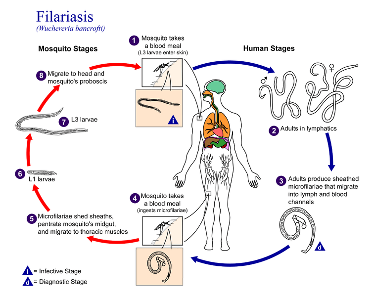 Filariasis vs Elephantiasis in Tabular Form