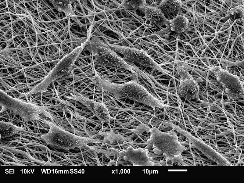 Fibroblast vs Myofibroblast in Tabular Form