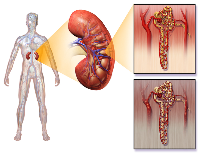 Uremia vs Azotemia in Tabular Form