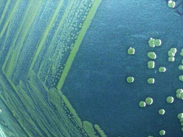 Amoebic Dysentery and Bacillary Dysentery - Side by Side Comparison 