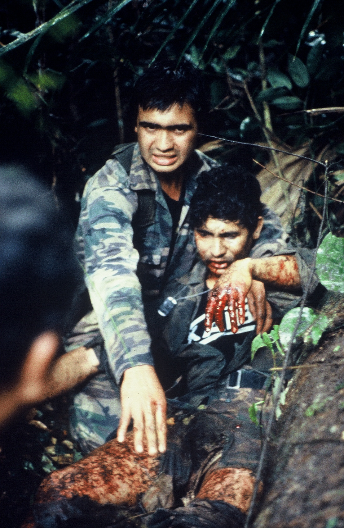 Guatemalan Lt Wounded By Mine Blast Guatemalan Lt Wounded By Mine Blast