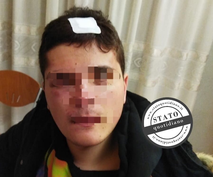 Manfredonia Brutale Aggressione A 18enne Bullizzato Da Un Branco