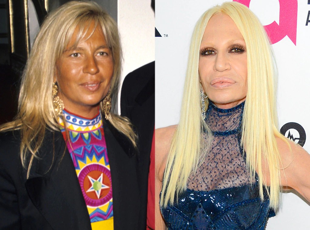 Donatella Versace from Face Changes That Shocked the World E! News