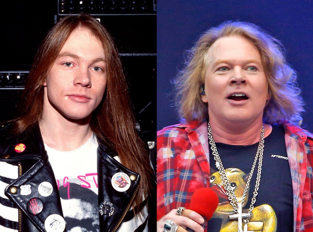 Axl Rose from Face Changes That Shocked the World E! News