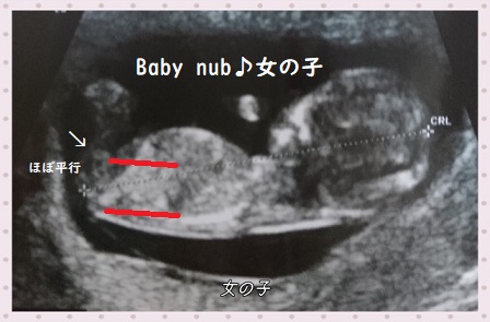 妊娠初期の性別 R先生の早期性別判定 ベビーナブとは アラフォー2児ママ育児日記 妊娠初期の性別 R先生の早期性別判定 ベビーナブとは アラフォー2児ママ育児日記